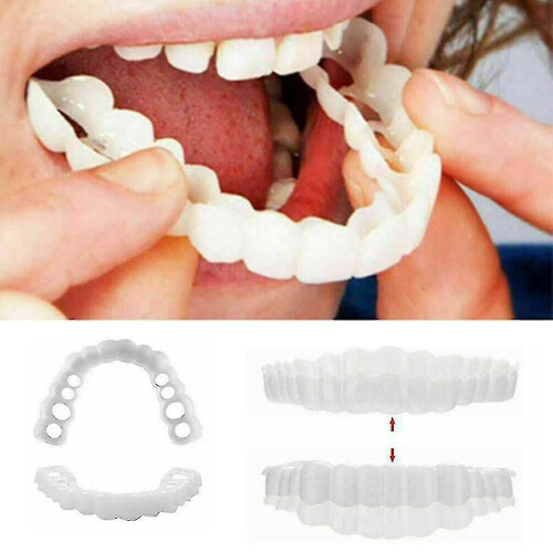Smile Snap On False Teeth Lower