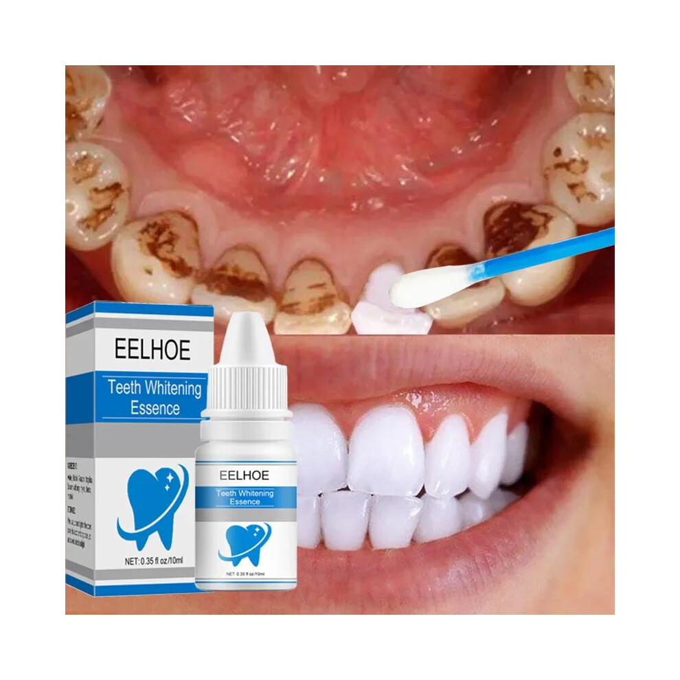 Teeth Whitening Essence Remove Against Dental Caries Plaque Dirt Serum Fresh Breath Oral Hygiene Dental Tooth Cleaning Tools