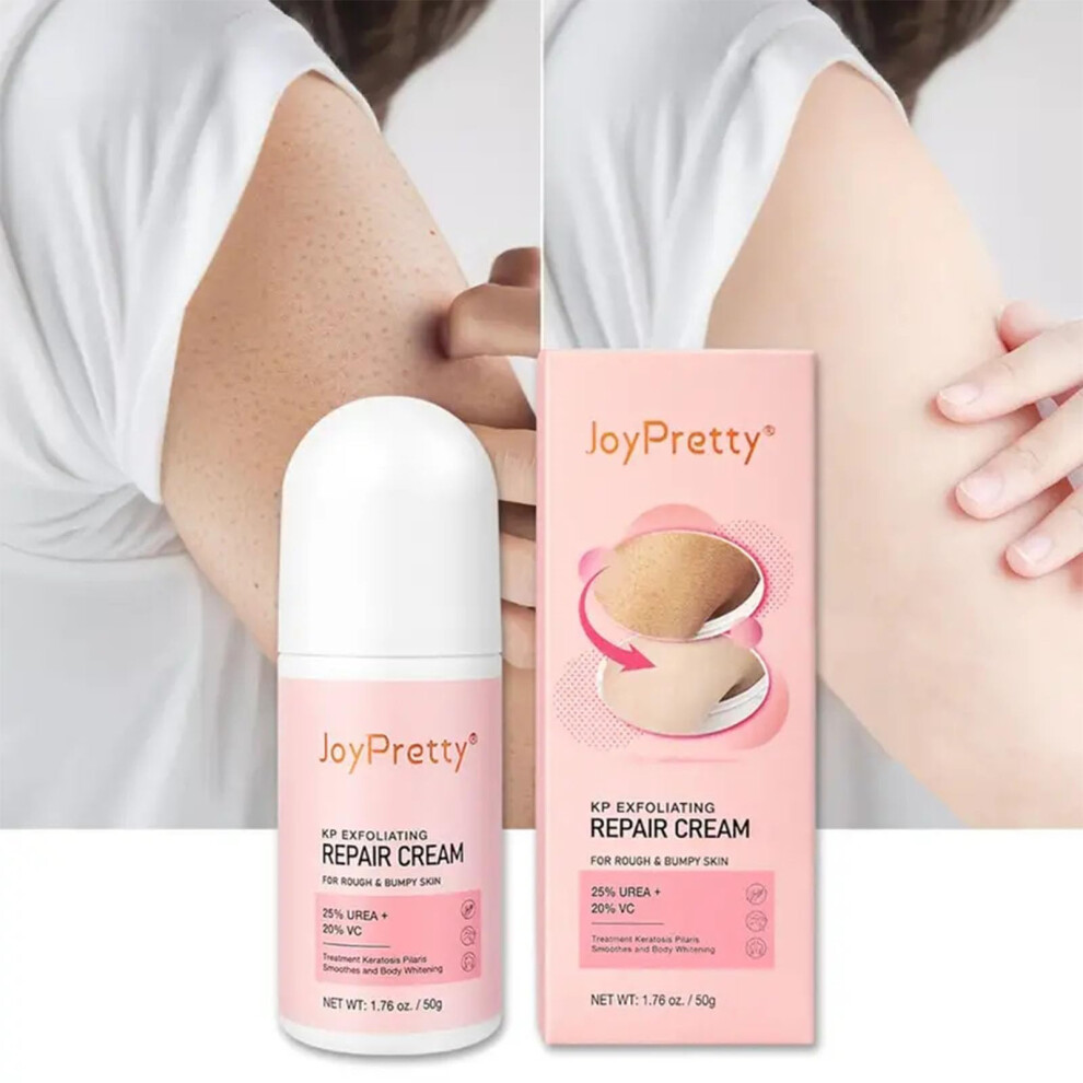 Keratosis Pilaris Lotion, Legs Treatment Body Cream Skin Exfoliating Repair Cream Chicken Skin Care Cream,Exfoliating Body Cream Rough Bumpy Skin Body