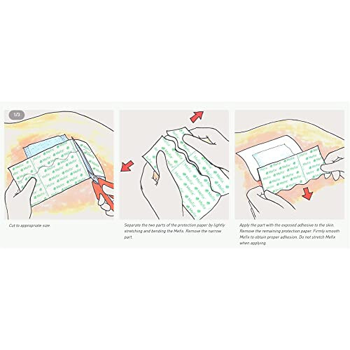 Mefix Adhesive Fabric Dressing, 5cm x 10M 2
