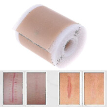 (4cmx1m) New Silicone Gel Scar Removal Leaf Treatment Patch For Acne Wound Burned Skin