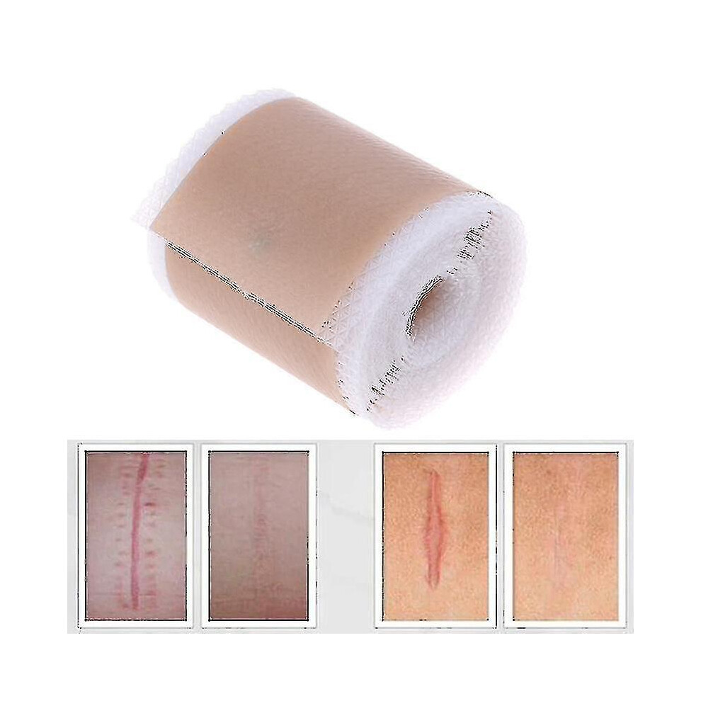 (4cmx1m) New Silicone Gel Scar Removal Leaf Treatment Patch For Acne Wound Burned Skin