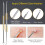 Blackhead Remover Pimple Popping Tool Kit 4