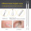 Blackhead Remover Pimple Popping Tool Kit 8