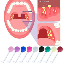(iron red) Tonsil Stone Removal Tool, Tonsil Stone Removal Vacuum Kit, Tonsil Stone Cupping Tool, Manual Cleaner Removal Oral Cleaning Oral Care Oral Cleaning