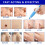 Auto Skin Tag Remover Painless Mole Wart With Cleansing Swabs 12