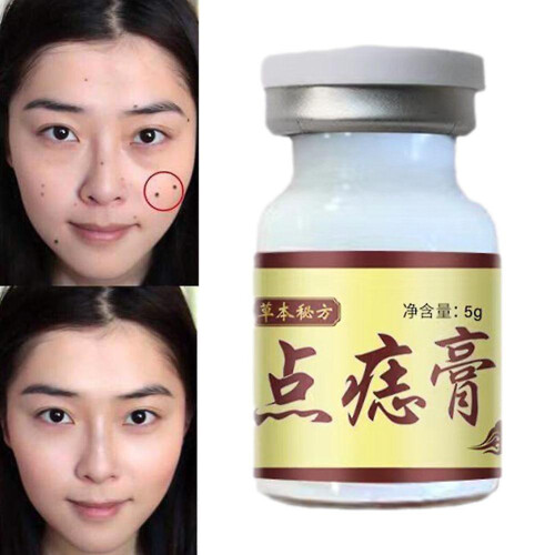 Seagril-concentrated Potent Skin Tag Removal Cream Concentrated Potent Skin Tag Removal Cream on OnBuy