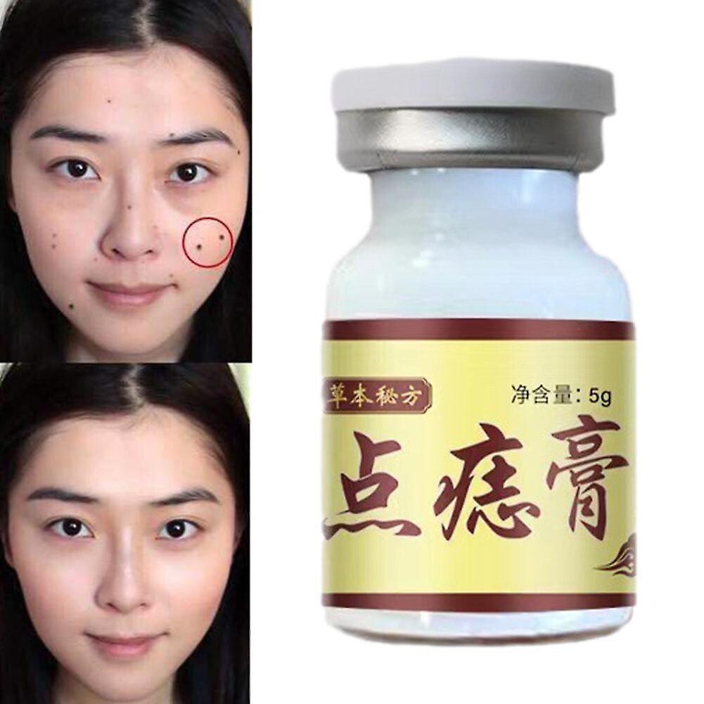 Seagril Contentrated Potent Skin Tag Removal Cream Concentrated Potent Skin Tag Removal Cream on OnBuy