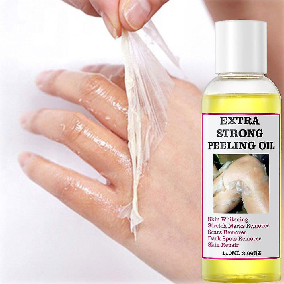 Extra Strength Yellow Peeling Oil Lightening Exfoliating Dark Skin Bleaching Oil