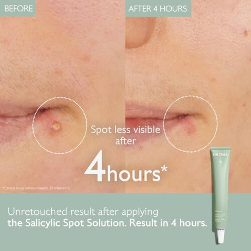 CAUDALIE Vinopure Salicylic Spot Solution - 15 mL 1