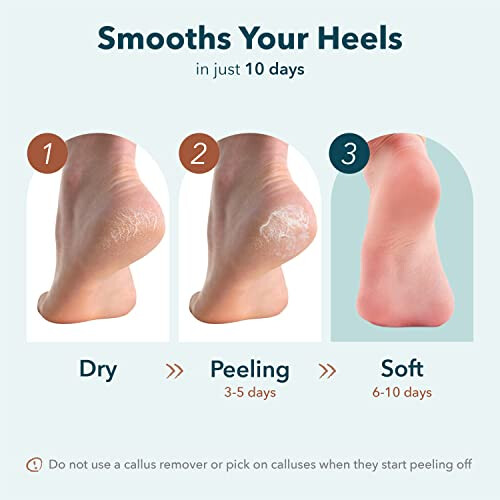 Exfoliating Heel Mask 2