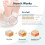 Exfoliating Heel Mask 4