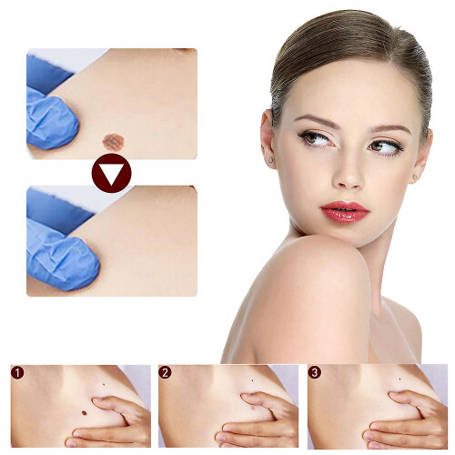 2pcs Wipe Off Tags And Mole Remover, Skin Tag Remover Liquid, Effectively Remove Skin Tags 2