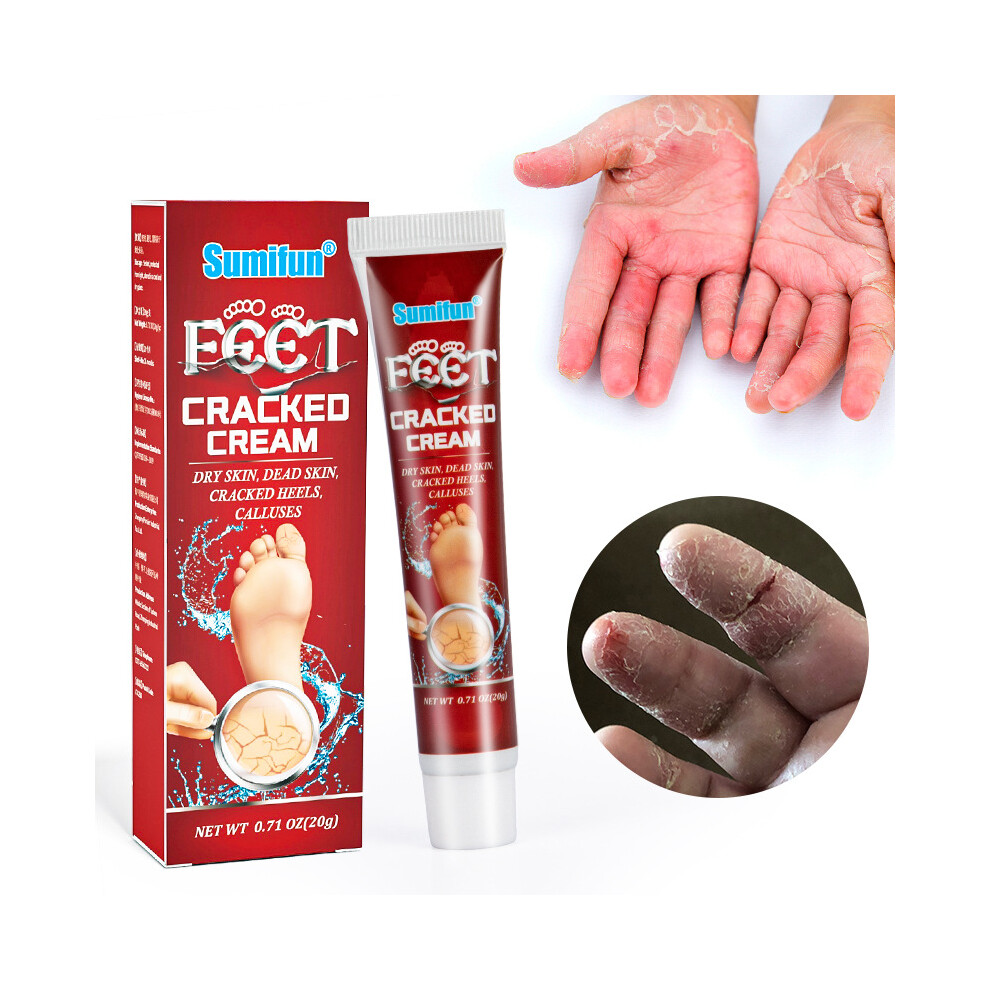 Flemye Cracked Hands And Feet Cream Anti-Frost Crack Cream