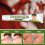 Psoriasis Cream Body Care Cream 5