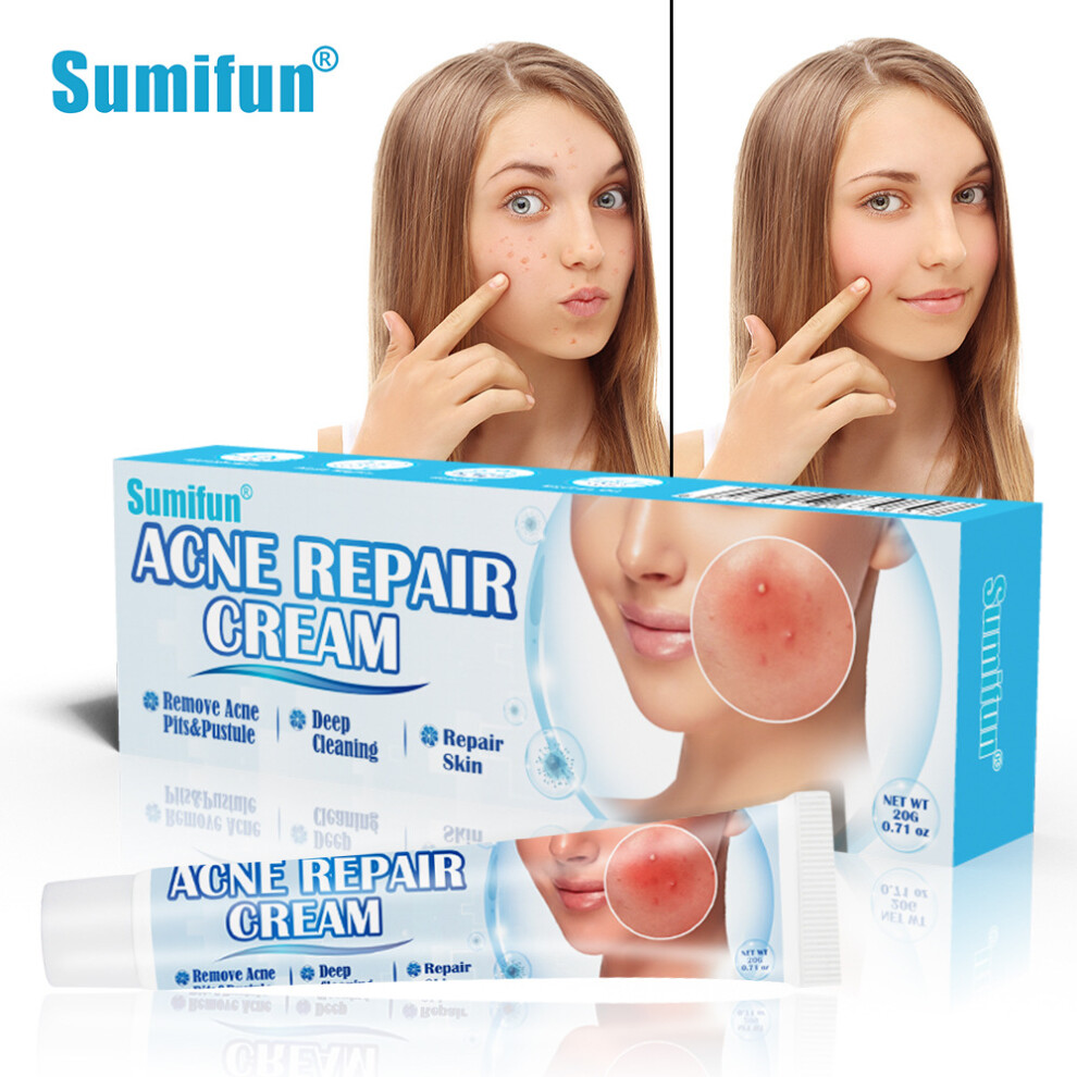 Flemye Cream Acne Repair Scar Repair Skin Care
