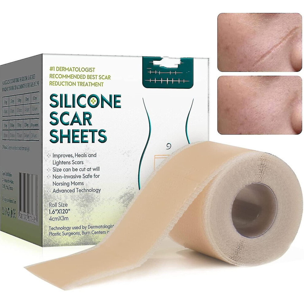 Silicone Plasters For Scars, Silicone Scar Films For Surgeries, Caesarean Section, Keloids, Burns,silicone Scar Tape-4cm*3m
