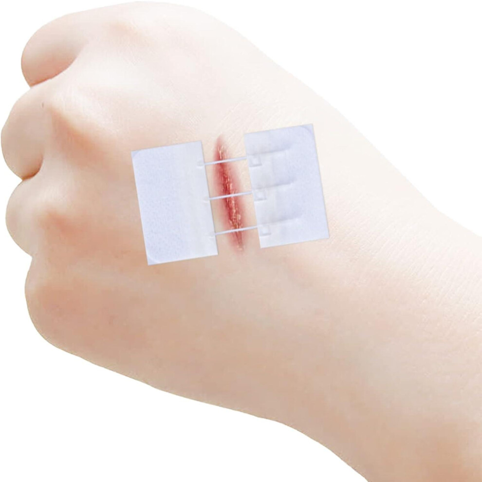 Sutures Butterfly Bandaids,emergency Laceration Closures,suture-free Wound Closure Device Sterile Strips Band Aid Survival First Aid Kit,for Scar Redu