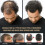 Root Activator Shampoo, Spartan Hair Loss Shampoo,shampoo Root Activator 1