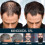 Regrowth 5% Topical For Men Solution. -n 3