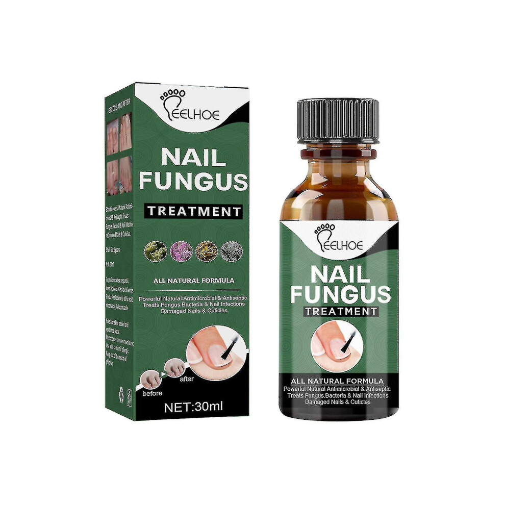 Extra Strong Nail Fungus Treatment, Best Nail Repair Stop Fungal Growth Effectiv