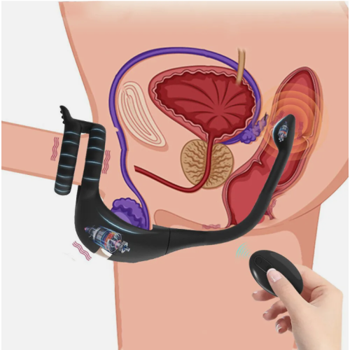 Cock Ring 9 Intense Vibrating Penis Ring Remote Control Male Vibrator 2