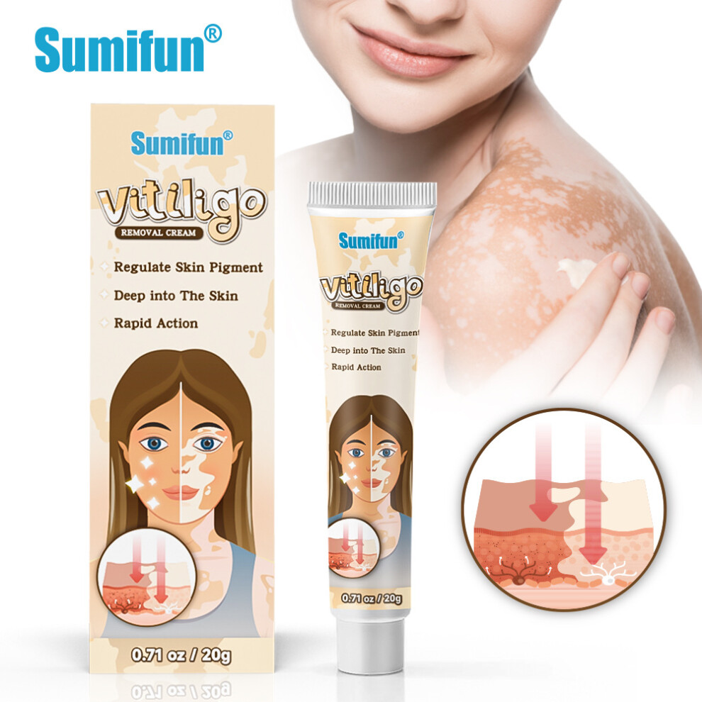Bghone White/Cream Spot Cleansing Vitiligo Repair, Skin Care