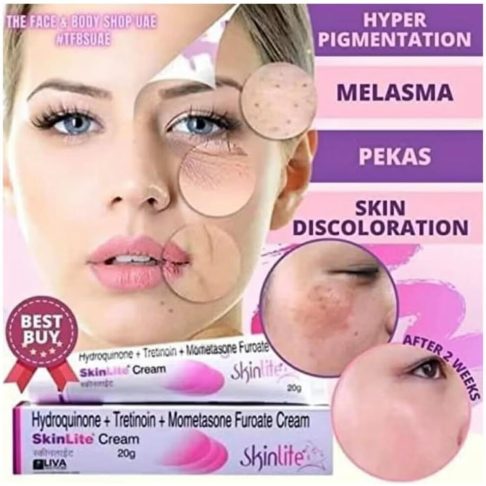 Skinlite Whitening, Brightening Nourishing & Reduces Wrinkles Cream for