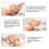(192 Microneedle Roller Gold, 0.5mm) Derma Roller Titanium Microneedle Roller Skin Care 6