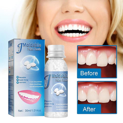 Temporary Tooth Repair Kit Resin Fix Broken False Teeth Fill Gaps Dental Denture 2