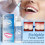 Temporary Tooth Repair Kit Resin Fix Broken False Teeth Fill Gaps Dental Denture 5