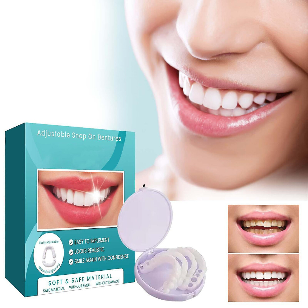 (2 pairs) Adjustable Snap-on Dentures, Veneers Denture Braces Plus Denture Cases, Temporary Fillings Braces Interdental Fillings Straightening Denture