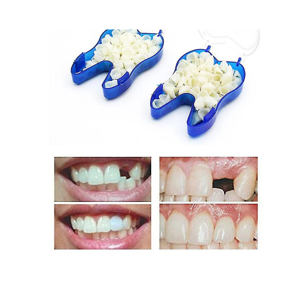 Temporary Denture Braces Occlude Upper Dentures Veneer Dentures Missing Teeth Broken Teeth