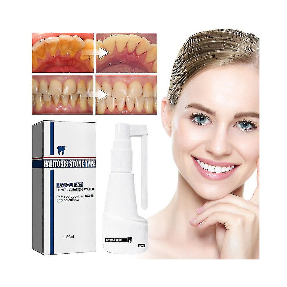 30ml Calculus Dissolving Dental Spray Oral Tooth Cleaner Tartar Remover