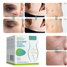 Silicone Scar Patch, Silicone Scar Tape Roll, Silicone Scar Strip, Reusable Scar Remover For Caesarean Portion, Keloid, Etc. 1.5m Long