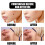(2pcs) 1-3pcs Fast Removal Skin Tag Mole Wart Remover Liquid Wipeoff Tags 2