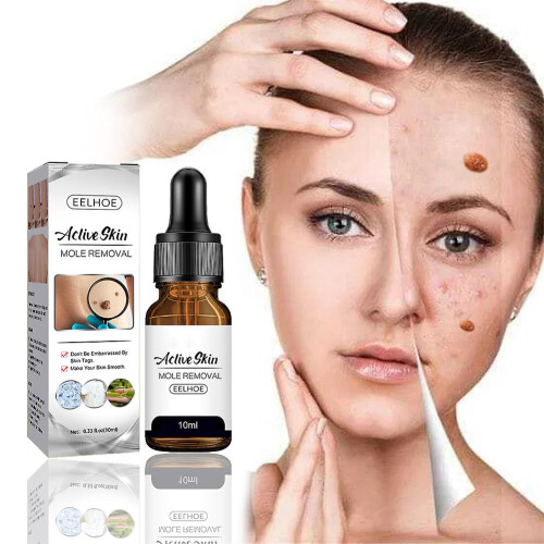 (2pcs) 1-3pcs Fast Removal Skin Tag Mole Wart Remover Liquid Wipeoff Tags 2