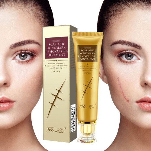 Scar repairing removing Scar cream 1