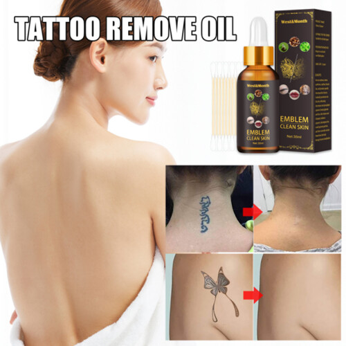 (onesize) 30ml Quick Tattoo Removal Liquid Agent Microblading Bleaching Makeup Permanent Corrector