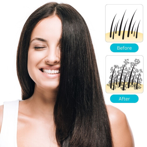 Hair Pro - Auburn / Rood 1
