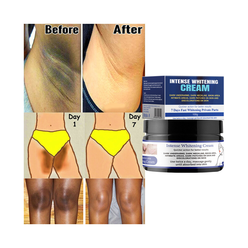 INTENSE WHITENING CREAM For Inner Thigh Dark Spots Skin Underarm