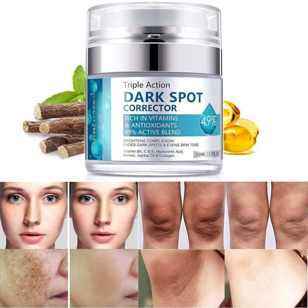 Dark Spot Remover for Face Body, Dark Spot Corrector, Natural Ingredient, Enriching Skin Care For All Skin Tones