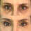 Dermaflage Παλέτα Διορθωτικών Χρωμάτων, Concealer για Μαύρους Κύκλους, Ερυθρότητα, Μώλωπες 3