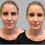 Dermaflage Παλέτα Διορθωτικών Χρωμάτων, Concealer για Μαύρους Κύκλους, Ερυθρότητα, Μώλωπες 4