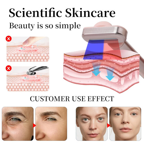 Eye Beauty Facial Wand (Silver(Red)) (Red + Blue Light) 2