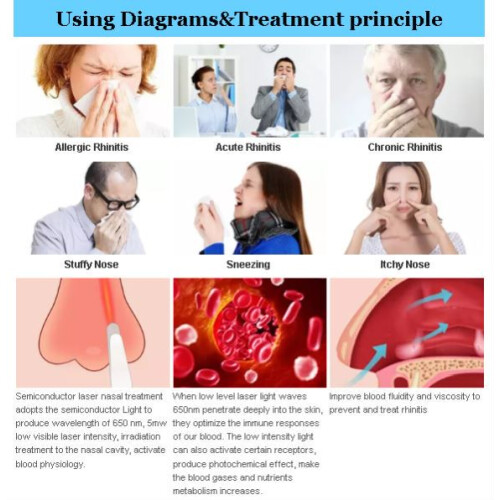 Nose Treatment Rhinitis Therapy Device 2