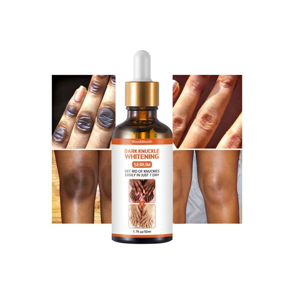 1PC-Hand and Knuckle Lightening Serum 50ml Lightening Serum for Dark Knuckles