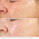 Kleem Organics Retinol Cream for Face (old Formula) 2