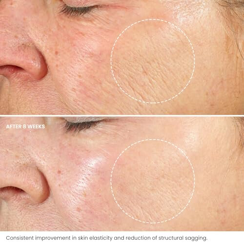 Kleem Organics Retinol Cream for Face (old Formula) 1