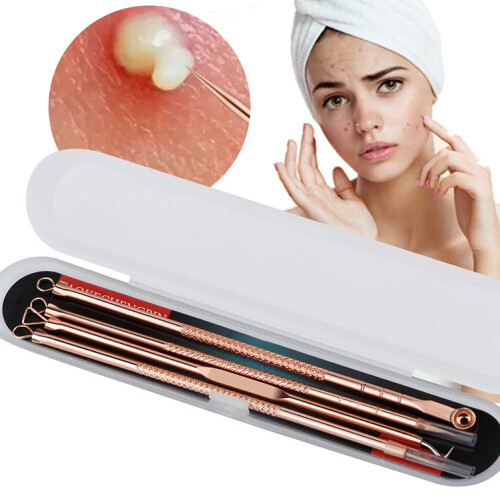 4PCS Blackhead Remover Pimple Comedone Extractor Tool Acne Kit 1